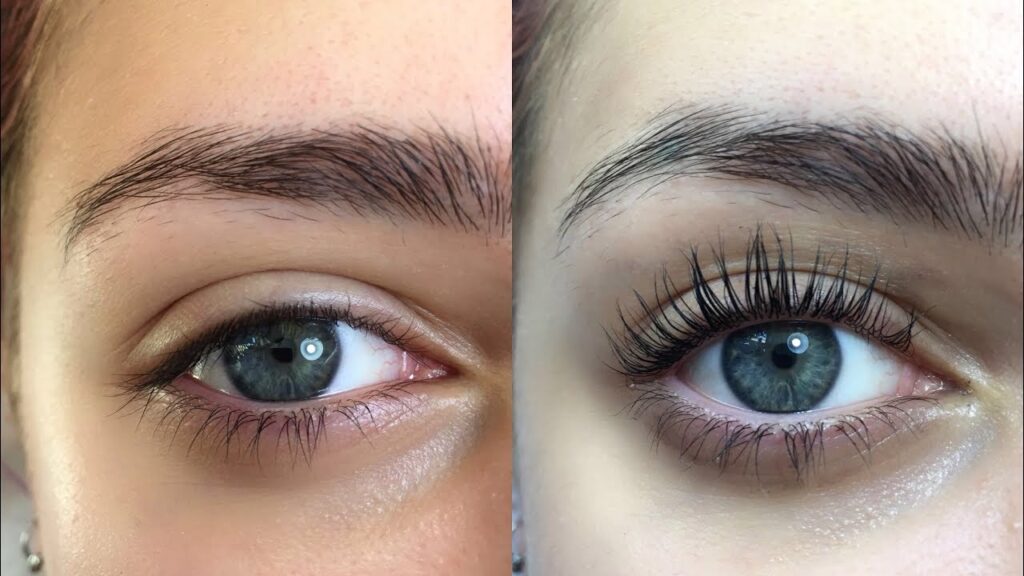 Antakya kirpik lifting